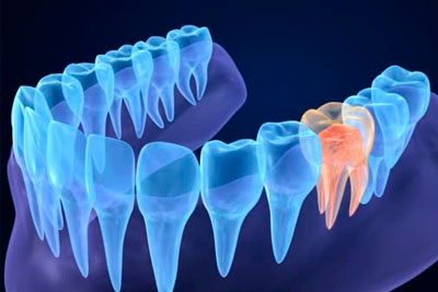 Endodontia em SP